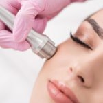 What-You-Need-to-Know-About-Home-Microdermabrasion-Treatment-on-contributionblog