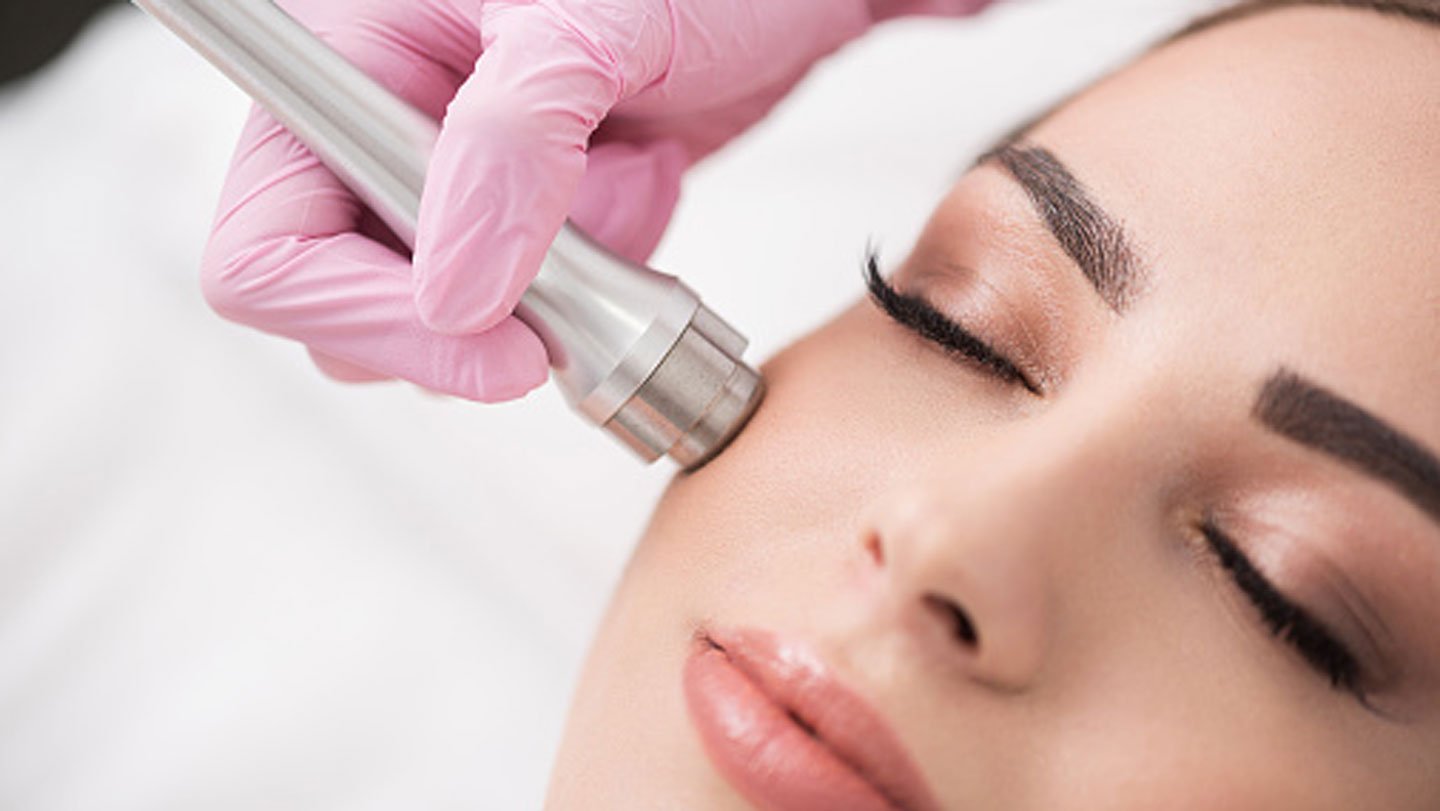 What You Need to Know About Home Microdermabrasion Treatment