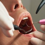 Let’s-Know-More-about-the-Types-of-Teeth-Emergency-on-contributionblog