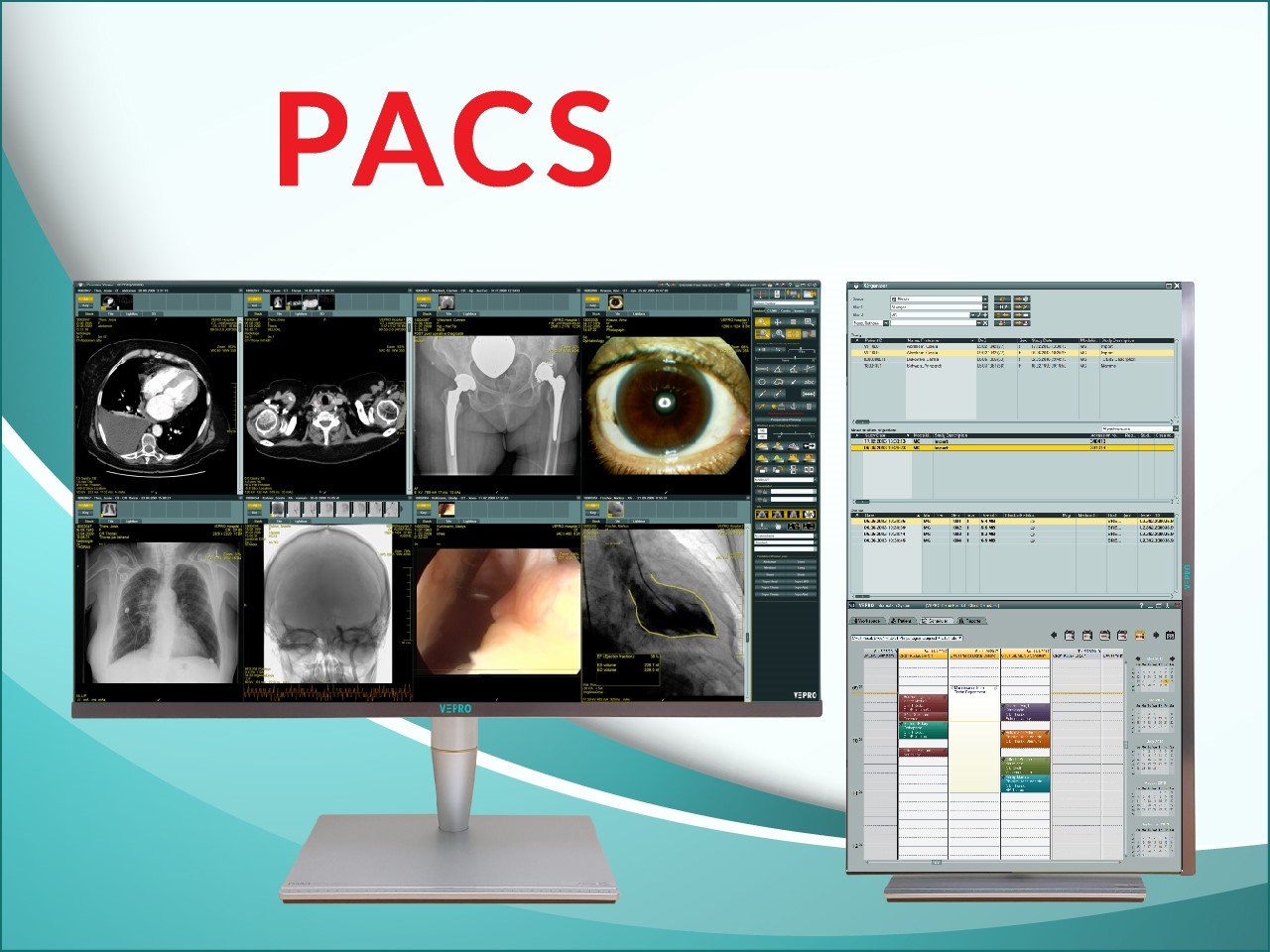 PACS System Vendors: Your Ultimate Guide to Choosing the Right Partner for Medical Imaging Success