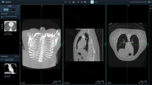 What Happens to Your Imaging Data?