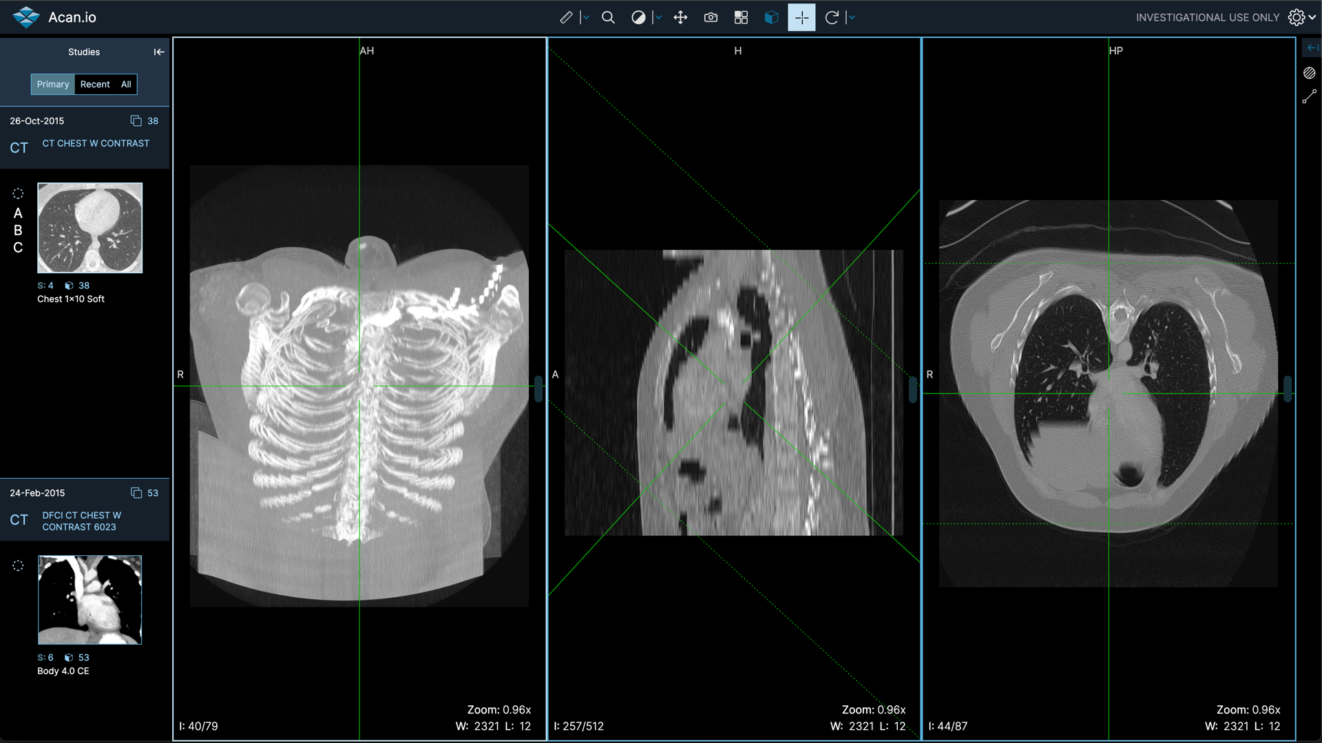 cloud DICOM viewer
